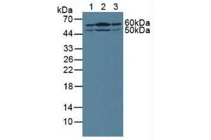Western blot analysis of (1) Human Liver Tissue, (2) Mouse Kidney Tissue and (3) Human PANC-1 Cells.