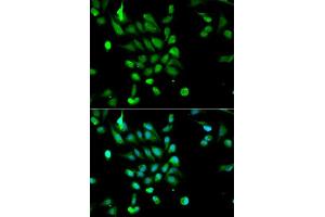 Immunofluorescence (IF) image for anti-Proteasome (Prosome, Macropain) 26S Subunit, ATPase, 5 (PSMC5) (AA 127-406) antibody (ABIN3022098)