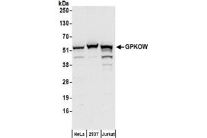 anti-G Patch Domain and KOW Motifs (GPKOW) (AA 426-476) antibody