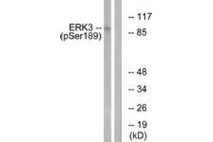 Western blot analysis of extracts from mouse brain, using ERK3 (Phospho-Ser189) Antibody. (MAPK6 Antikörper  (pSer189))