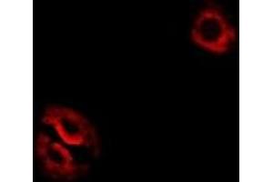 Immunofluorescent analysis of RPL14 staining in Hela cells. (RPL14 Antikörper)