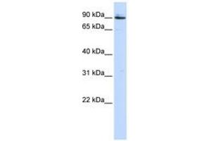 Image no. 1 for anti-Proprotein Convertase Subtilisin/kexin Type 5 (PCSK5) (AA 792-841) antibody (ABIN6743186) (PCSK5 Antikörper  (AA 792-841))