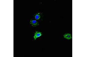 Immunofluorescent analysis of Hela cells using ABIN7142866 at dilution of 1:100 and Alexa Fluor 488-congugated AffiniPure Goat Anti-Rabbit IgG(H+L) (MMP2 Antikörper  (AA 445-660))