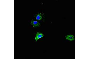Immunofluorescent analysis of Hela cells using ABIN7142866 at dilution of 1:100 and Alexa Fluor 488-congugated AffiniPure Goat Anti-Rabbit IgG(H+L)