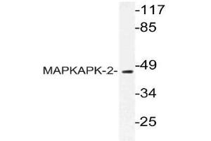 Western blot (WB) analysis of MAPKAPK-2 antibody in extracts from HUVEC cells. (MAPKAP Kinase 2 Antikörper)
