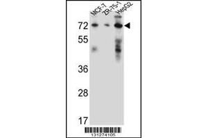 Western blot analysis in MCF-7,ZR-75-1,HepG2 cell line lysates (35ug/lane). (HSD17B4 Antikörper  (AA 341-370))