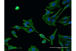 Immunofluorescence of monoclonal antibody to ALS2 on HeLa cell. (ALS2 Antikörper  (AA 221-320))