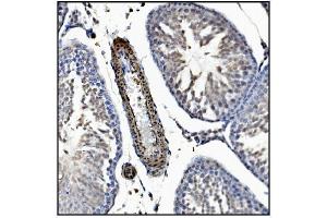 IHC analysis of TAGLN/Transgelin using anti-TAGLN/Transgelin antibody (ABIN7600099).