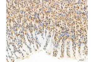 ABIN6263714 and ABIN6272970 at 1/100 staining Rat stomach tissue by IHC-P.