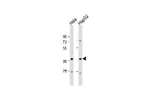 All lanes : Anti-C1GALT1C1 Antibody (N-Term) at 1:2000 dilution Lane 1: Hela whole cell lysate Lane 2: HepG2 whole cell lysate Lysates/proteins at 20 μg per lane. (C1GALT1C1 Antikörper  (AA 26-60))