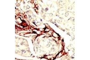 Immunohistochemistry (Paraffin-embedded Sections) (IHC (p)) image for anti-serine/threonine Kinase 11 (STK11) (AA 14-44), (N-Term) antibody (ABIN391350)