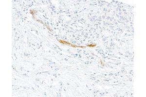 Immunohistochemistry (IHC) image for anti-Selectin E (SELE) (AA 22-555) antibody (ABIN7795699) (Rekombinanter Selectin E/CD62e Antikörper  (AA 22-555))