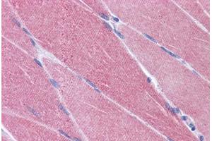 Human Skeletal Muscle: Formalin-Fixed, Paraffin-Embedded (FFPE) (CREB3L1 Antikörper  (AA 497-509))