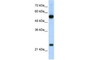 RPL13 antibody used at 2. (RPL13 Antikörper  (C-Term))