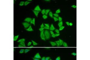 Immunofluorescence analysis of A549 cells using GSTM2 Polyclonal Antibody