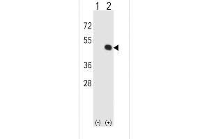 Western blot analysis of HLA-E (arrow) using rabbit polyclonal HLA-E Antibody (Center) (ABIN652456 and ABIN2842310).
