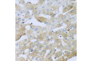 Immunohistochemistry of paraffin-embedded human liver injury using AP1M2 antibody. (AP1m2 Antikörper  (AA 164-423))