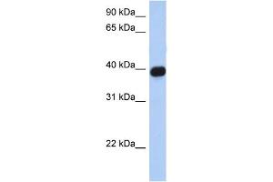 WB Suggested Anti-CXCR6 Antibody Titration:  0. (CXCR6 Antikörper  (N-Term))
