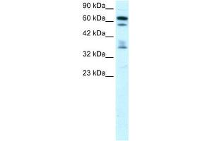 WB Suggested Anti-ZNF512 Antibody Titration: 0. (ZNF512 Antikörper  (Middle Region))