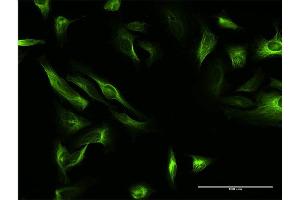 Immunofluorescence of purified MaxPab antibody to MAP7 on HeLa cell.