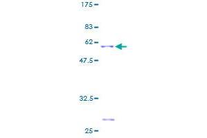 EIF4E2 Protein (AA 1-245) (GST tag)