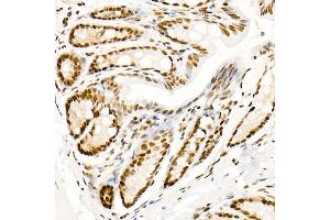 Immunohistochemistry of paraffin-embedded mouse colon using Phospho-POLR2A CTD-S5 Rabbit mAb  at dilution of 1:200 (40x lens).