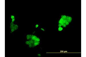 Immunofluorescence of monoclonal antibody to PGR on A-431 cell. (Progesterone Receptor Antikörper  (AA 1-110))