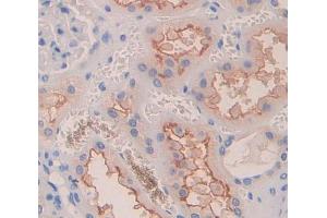IHC-P analysis of Human Tissue, with DAB staining. (Dysferlin Antikörper  (AA 1-479))