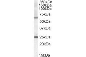 Western Blotting (WB) image for anti-Collagen, Type IV, alpha 3 (Goodpasture Antigen) Binding Protein (COL4A3BP) (AA 662-672) antibody (ABIN293420) (COL4A3BP Antikörper  (AA 662-672))