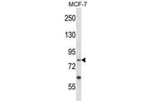 PRKRIR Antibody (N-term) western blot analysis in MCF-7 cell line lysates (35µg/lane). (PRKRIR Antikörper  (N-Term))
