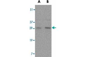Western blot analysis of TNFSF11 in rat liver tissue lysate with TNFSF11 polyclonal antibody  at (A) 0. (RANKL Antikörper  (Internal Region))