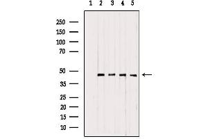 Western blot analysis of extracts from various samples, using UQCRC1 antibody.