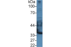 Western blot analysis of Rat Heart lysate, using Mouse EPYC Antibody (3 µg/ml) and HRP-conjugated Goat Anti-Rabbit antibody ( (EPYC Antikörper  (AA 130-322))