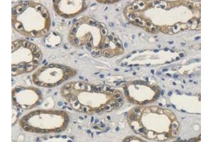 DAB staining on IHC-P; Samples: Human Kidney Tissue (FGF10 Antikörper  (AA 38-208))