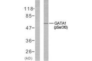 Western blot analysis of extracts from COS7 cells treated with EPO, using GATA1 (Phospho-Ser310) Antibody. (GATA1 Antikörper  (pSer310))