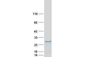 Western Blotting (WB) image for DEAD (Asp-Glu-Ala-Asp) Box Polypeptide 17 (DDX17) (Transcript Variant 2) protein (Myc-DYKDDDDK Tag) (ABIN2719317)