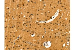 Phospho-MEF2C (Ser222) Antibody at 1/100 staining Mouse brain tissue by IHC-P.