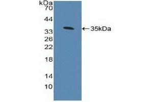 Detection of Recombinant AhR, Human using Polyclonal Antibody to Aryl Hydrocarbon Receptor (AhR) (Aryl Hydrocarbon Receptor Antikörper  (AA 128-399))