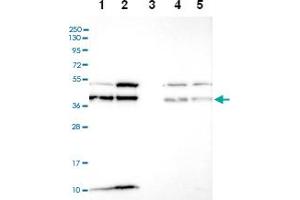 Western blot analysis of Lane 1: RT-4 Lane 2: U-251 MG Lane 3: Human Plasma Lane 4: Liver Lane 5: Tonsil with C6orf47 polyclonal antibody ( Cat # PAB28310) at 1:100-1:250 dilution. (C6orf47 Antikörper)