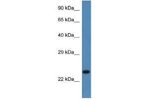 WB Suggested Anti-Ssr2 Antibody   Titration: 1.
