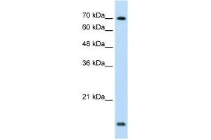 WB Suggested Anti-UBE2L3 Antibody Titration:  1. (UBE2L3 Antikörper  (C-Term))