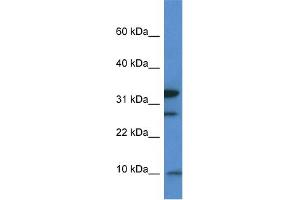 WB Suggested Anti-Mrps33 Antibody Titration: 1. (MRPS33 Antikörper  (Middle Region))