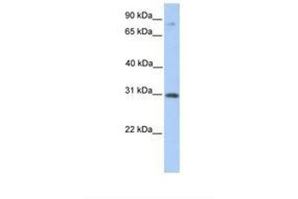 ABHD13 Antikörper  (C-Term)