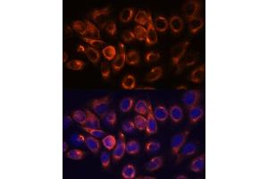 Immunofluorescence analysis of HeLa cells using  antibody (ABIN7265713) at dilution of 1:100. (ATL2 Antikörper  (AA 390-470))