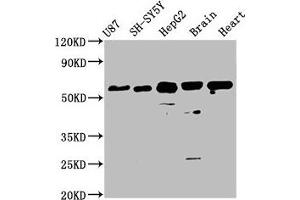 Western Blot Positive WB detected in: U87 whole cell lysate, SH-SY5Y whole cell lysate, HepG2 whole cell lysate, Mouse brain tissue, Rat heart tissue All lanes: CPNE7 antibody at 3. (CPNE7 Antikörper  (AA 254-393))