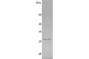 Western Blotting (WB) image for TGF-beta Activated Kinase 1/MAP3K7 Binding Protein 1 (TAB1) (AA 1-200) protein (His tag) (ABIN7125344) (TAB1 Protein (AA 1-200) (His tag))
