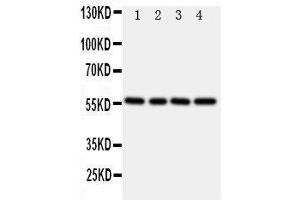Anti-TXNRD2 antibody, Western blotting Lane 1: Rat Kidney Tissue Lysate Lane 2: Rat Ovary Tissue Lysate Lane 3: Rat Liver Tissue Lysate Lane 4: SMMC Cell Lysate (TXNRD2 Antikörper  (C-Term))