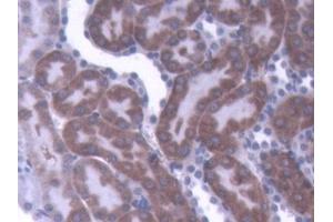 DAB staining on IHC-P; Samples: Rat Kidney Tissue (IL-1 beta Antikörper  (AA 117-268))
