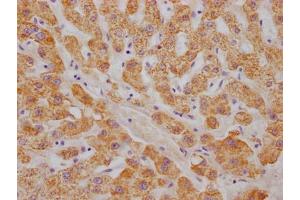 IHC image of ABIN7127317 diluted at 1:100 and staining in paraffin-embedded human liver tissue performed on a Leica BondTM system. (Rekombinanter ABAT Antikörper)