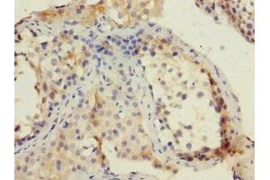 Immunohistochemistry of paraffin-embedded human testis tissue using ABIN7151292 at dilution of 1:100 (TRIP12 Antikörper  (AA 1-240))